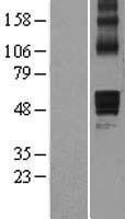 NBL1-07162 - AADACL1 Lysate